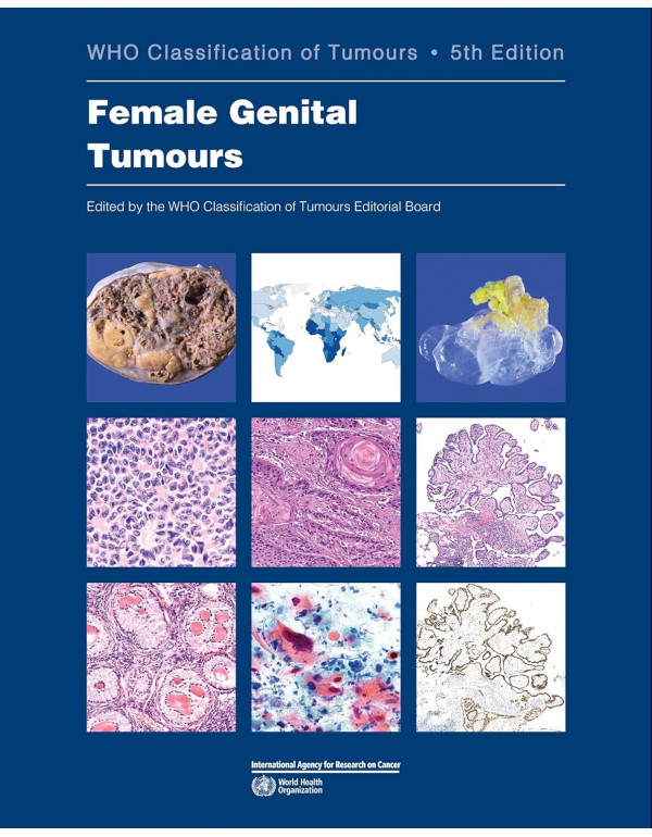 WHO Classification Of Tumours Female Genital Tumor...