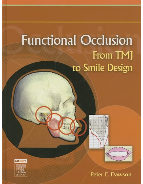 Functional Occlusion: From TMJ to Smile Design by ...